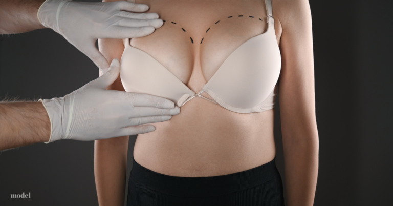 breast implant questions